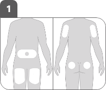 auto-step1